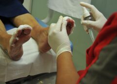 La Facultad de Educación Física y Deporte de la UAS ofrece servicios de podología a bajo costo para el público en general; busca prevenir con atención accesible